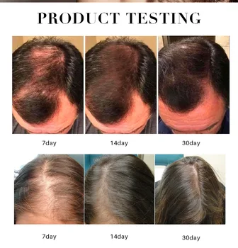 Naujas Greitą Plaukų Augimą eterinis Aliejus, 30ml Plaukų Slinkimas Produktų, Gydymo Atauga, Imbieras Serumas Esmė Plaukų Priežiūra Moterims, Vyrams