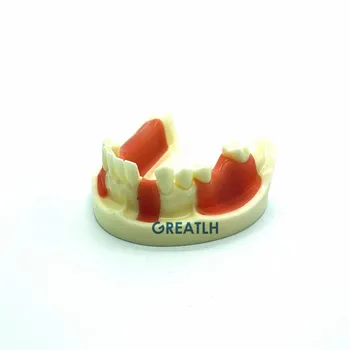 Dantų Implantai Praktikos modelio Apatinio Žandikaulio modelį su trūkstamus dantis pjovimo ir siuvimo Typodont Dantų Modelį su Gingiva